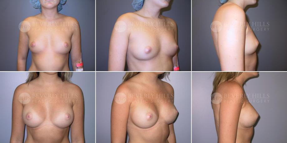 Beverly Hills Plastic Surgery gallery image 492