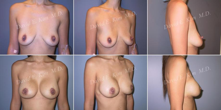 Beverly Hills Plastic Surgery gallery image 493
