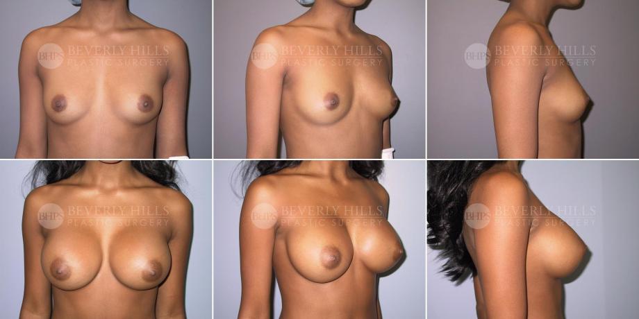 Beverly Hills Plastic Surgery gallery image 496