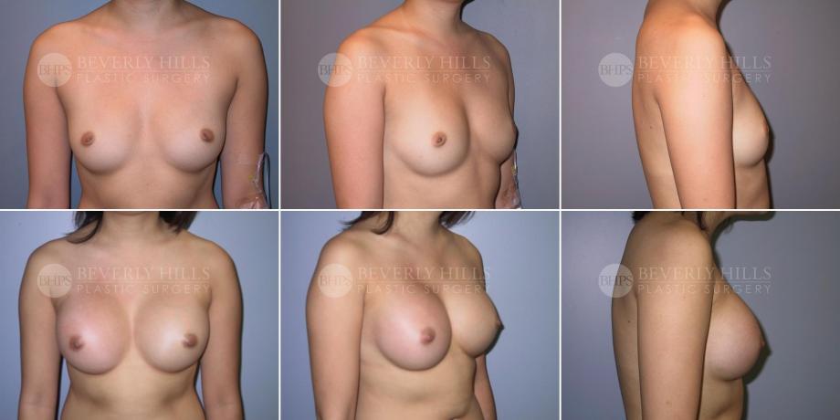 Beverly Hills Plastic Surgery gallery image 498