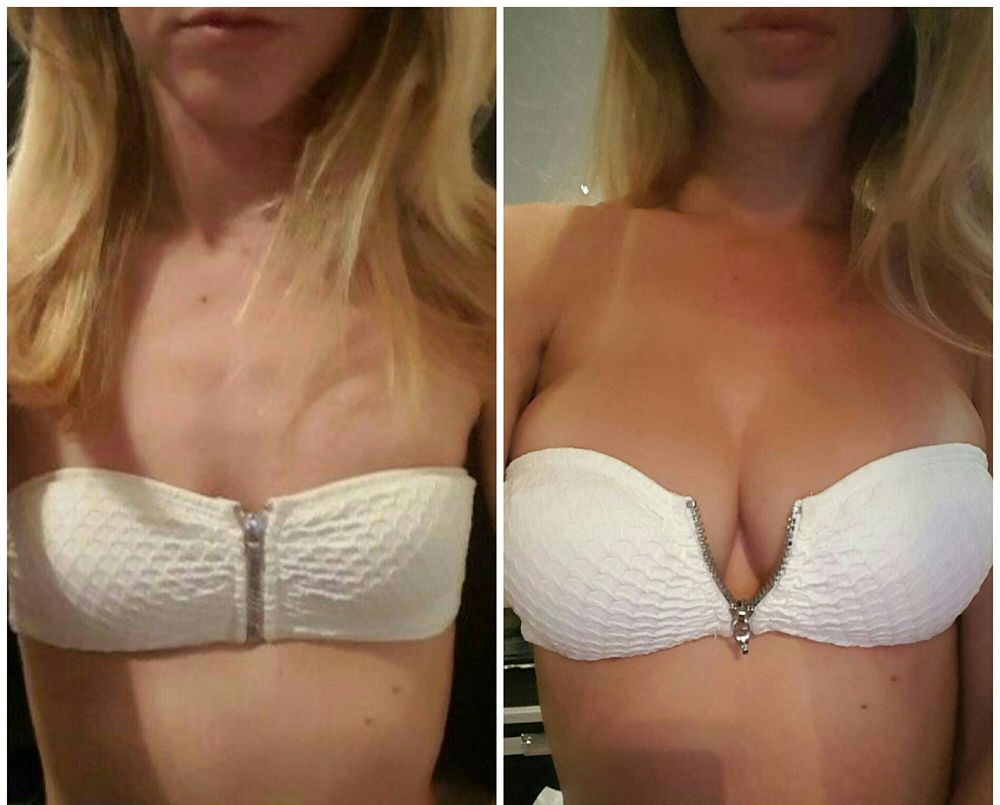 Beverly Hills Plastic Surgery gallery image 2